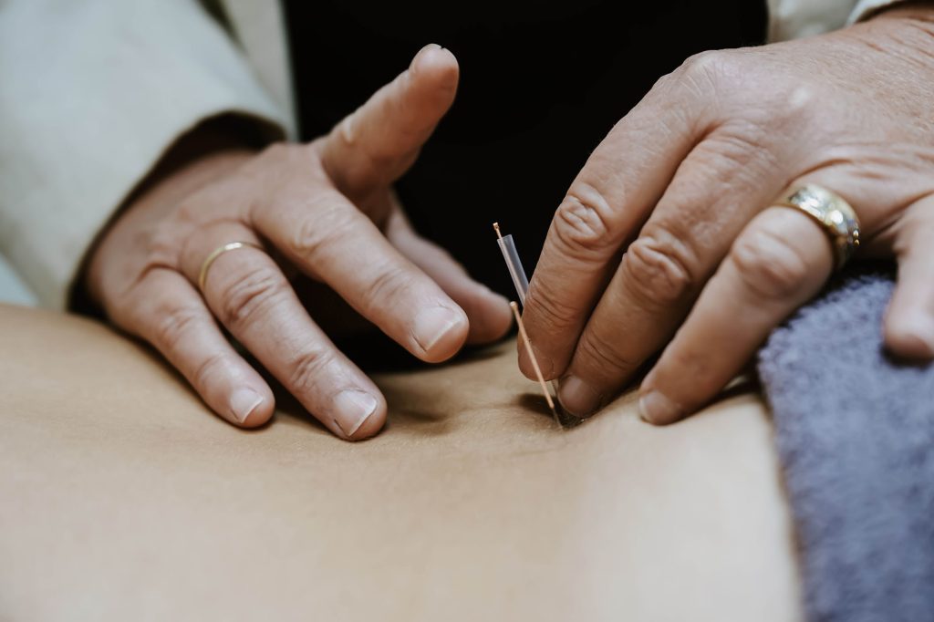 back pain needling
